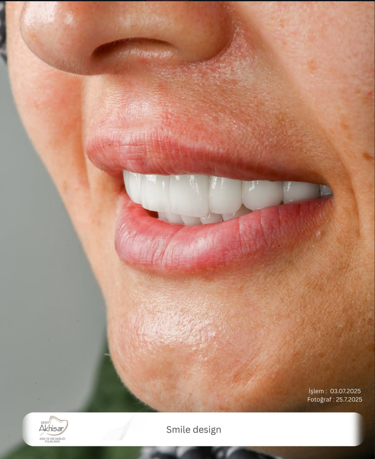 DENT AKHİSAR - ekran-resmi-2026-02-07-23-13-21.png