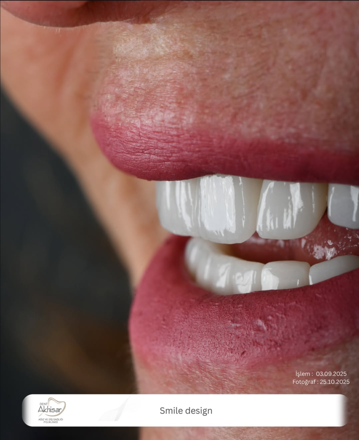 DENT AKHİSAR - ekran-resmi-2026-02-07-23-13-30.png