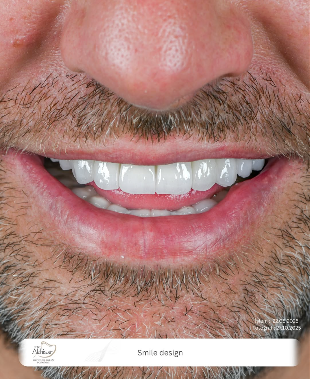 DENT AKHİSAR - ekran-resmi-2026-02-07-23-13-42.png