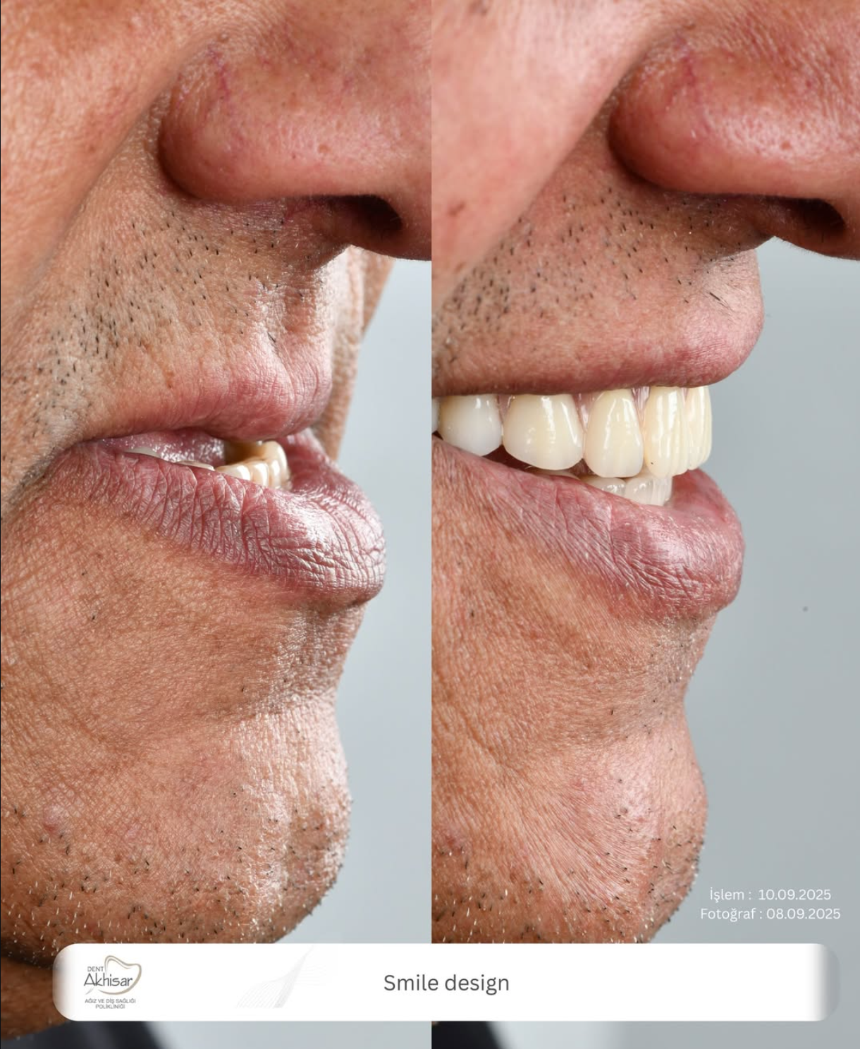 DENT AKHİSAR - ekran-resmi-2026-02-07-23-13-57.png